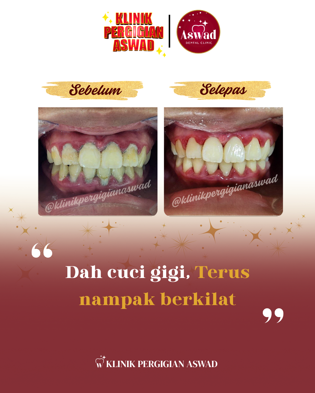 5_20250926_114500_0000