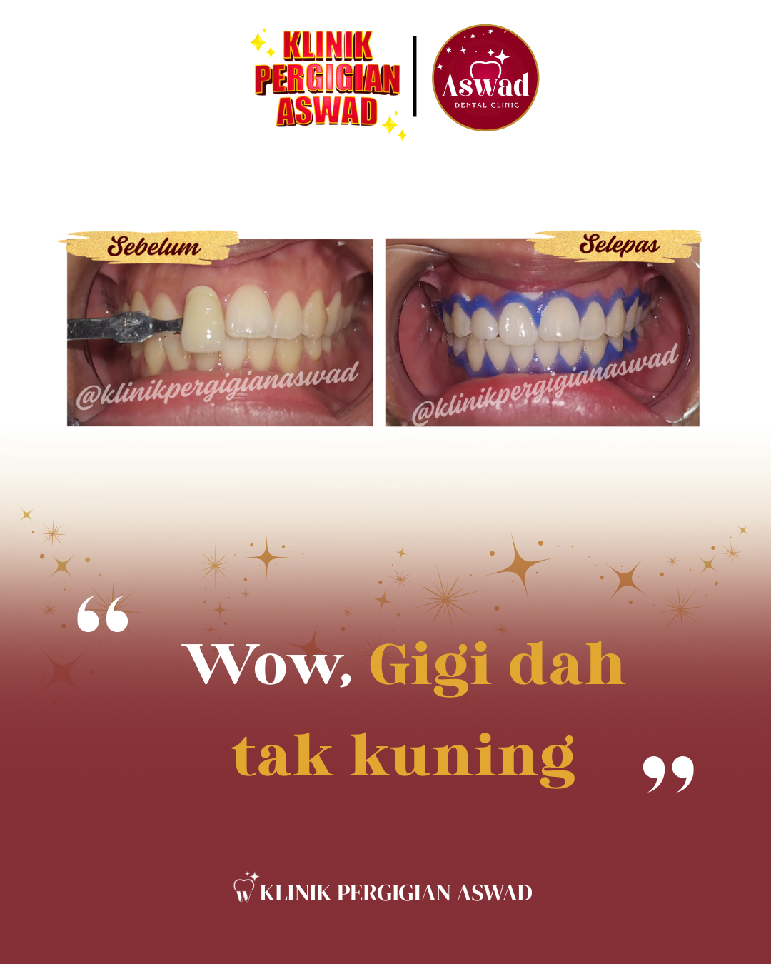 6_20250926_114500_0001