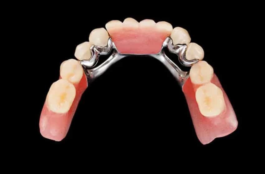 cobalt chrome dentures