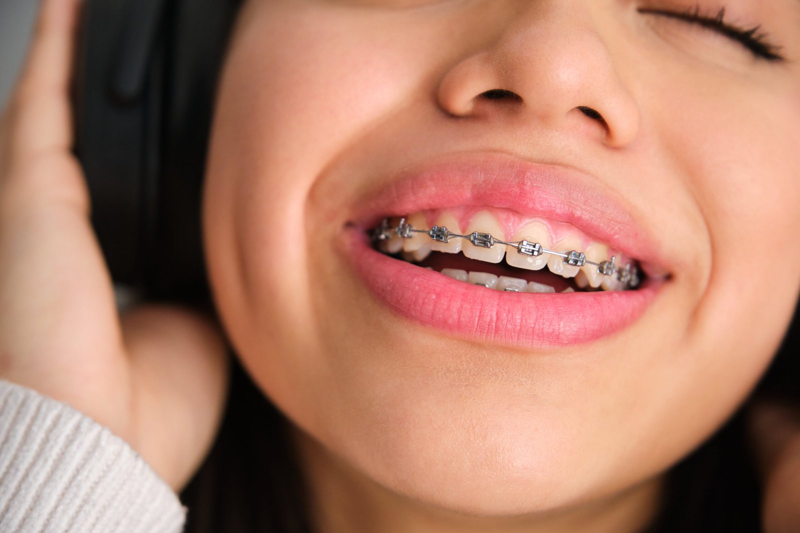 Braces treatment in Kuantan