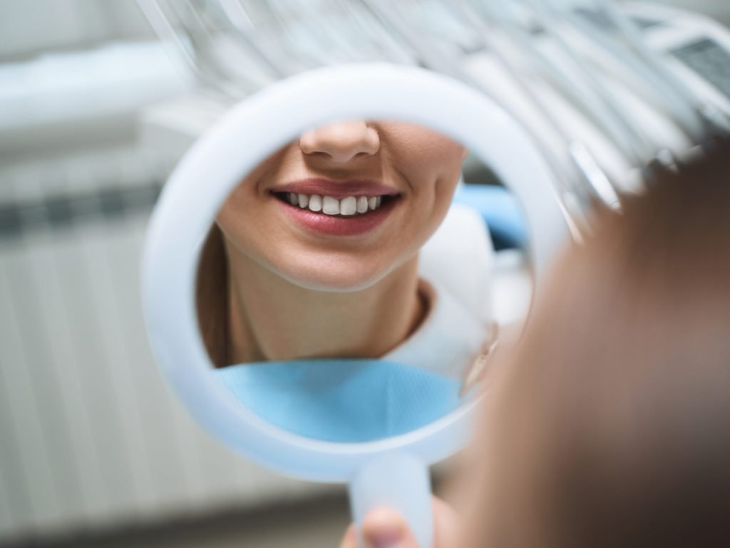teeth whitening services