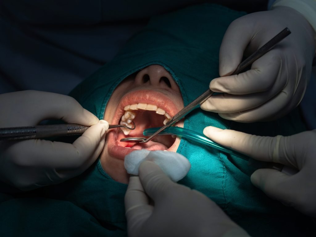 surgical tooth extraction